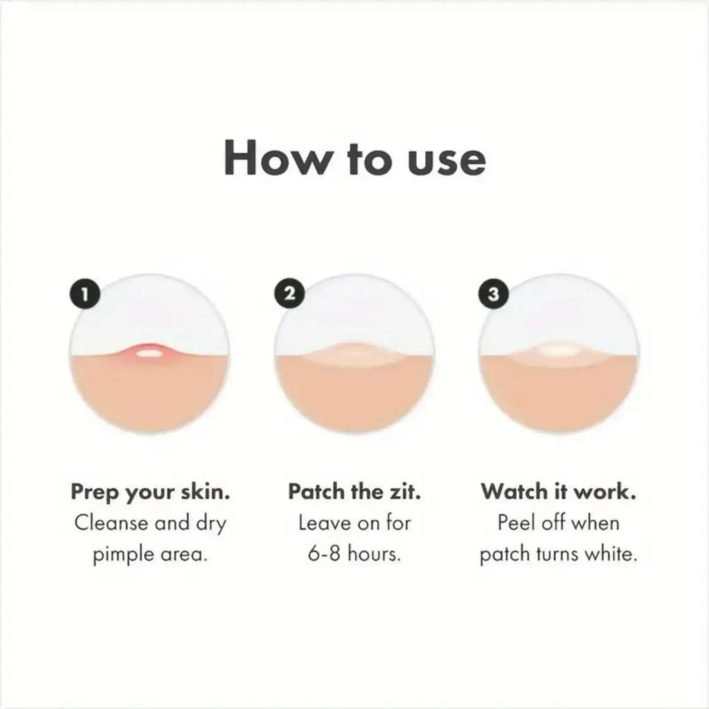 40 pieces of multi-color star acne patches, facial acne patches, concealer acne patches, and pimples patches, ultra-thin.